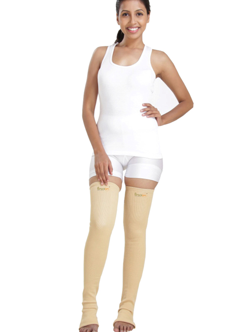 Varicose Veins - Image 3